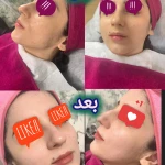  کلبه پوست لاوین