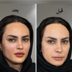 کلینیک زیبایی و لاغری بلو بیوتی|پاسداران