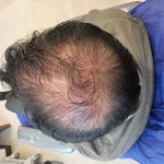 پاکسازی پوست(فیشال) و خدمات مو مرجان آرا