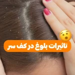 تصویر مرکزتخصصی رنگ مو، درمان اسکالپ مو عارفه باقری