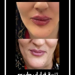 مرکز کلینیک لیزر زیبایی پوست و مو آسا