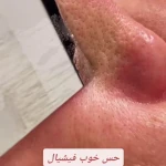  کیلینک پوست مو و لیزر نورا
