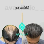 تصویر کلینیک تخصصی پوست و کاشت مو آوا
