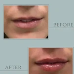 مركز ليزر و لاغري آيسان