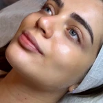 فیشیالیست (خدمات تخصصی پوست) هنگامه