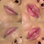 کلینیک پوست مو زیبایی و لیزر سلام پوست
