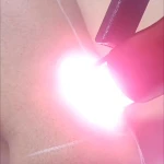 کلینیک  لیزر موهای زائد و زیبایی مهرنیا