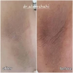 متخصص پوست مو زیبایی لیزر دکتر فرزانه علمشاهی