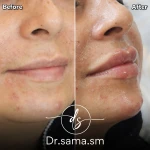 مطب پوست و مو زیبایی دکتر سما