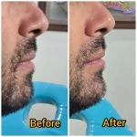 نمونه کار کلینیک زیبایی و لیزر مو گندم