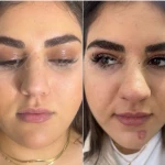 کلینیک پوست مو زیبایی و لیزر سارا