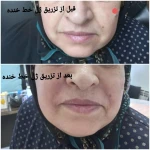 مرکز زیبایی ابریشم