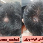 مرکز زیبایی و لیزر دکتر رضا نادری