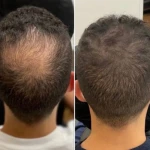 تصویر کلینیک پوست و مو و لیزر آتن