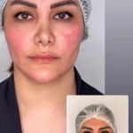 کلینیک زیبایی و لیزر لوسیفر