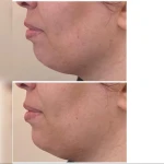 مطب زیبایی دکتر بهمنی