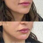 مرکز پوست و مو و لیزر دکتر مهتاب رضوی