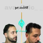 تصویر کلینیک تخصصی پوست و کاشت مو آوا