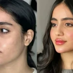 تصویر کلینیک زیبایی و فیشال ویونا سلامت