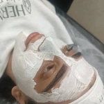 لیزر موهای زائد و پاکسازی پوست نوترسا