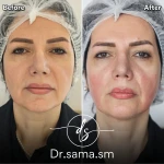 مطب پوست و مو زیبایی دکتر سما