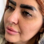 مطب پوست،مو ، زیبایی ولیزر