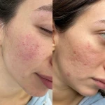 مرکز لیزر کلینیک زیبایی دنیای نقره ای