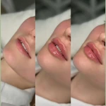 کلینیک زیبایی شارو
