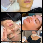 فشیال و پاکسازی پوست اوپال