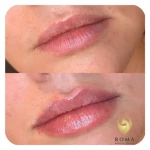 کلینیک زیبایی روما