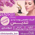 نمونه کار لیزر تندیس