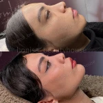 مرکز لیزر و زیبایی هانیسا