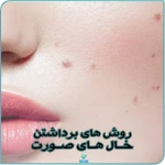 کلینیک  پوست مو زیبایی آلند
