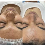  خدمات فیشیال  اسکالپ زعفرانیه(50% تخفیف)