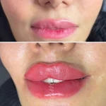 کلینیک پوست مو زیبایی و لیزر سارا
