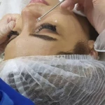 نمونه کار مرکز لیزر و فیشال دکتر خالقیان