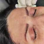 مرکز زیبایی بوتاکس و ژل و لیزر نایس