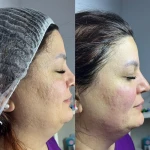 نمونه کار کلینیک تخصصی پوست و مو آرام