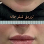  کلینیک پوست مو لیزر لاغری زیباریس