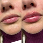 کلینیک پوست مو زیبایی و لیزر آیسل
