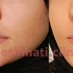نمونه کار کلینیک پوست مو زیبایی دکتر حشمتی