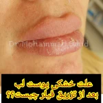 دکتر محمد امید بهترین دکتر زیبایی کانتور