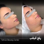 کلینیک زیبایی تهران بیوتی سنتر