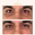کلینیک تزریق فیلر و بوتاکس زرفیس