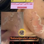  آموزشگاه وخدمات پاکسازی پوست جواهری