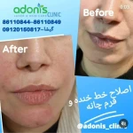 کلینیک پوست مو زیبایی و لیزر آدونیس