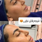 فیشال تخصصی  سعیده صدیقی