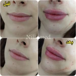 کلینیک پوست مو زیبایی و لیزر نیل