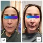 متخصص پوست مو زیبایی لیزر دکتر فرزانه علمشاهی