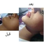 لوگوی فیلر و بوتاکس  بیوتی